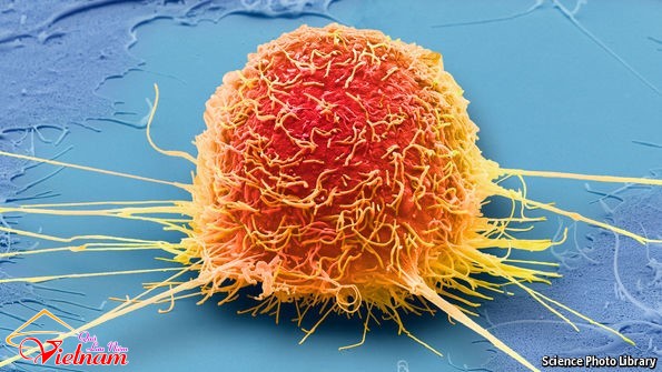 Ai cũng có tế bào ung thư trong cơ thể: 3 nguyên tắc vàng chặn đứng sự hình thành khối u