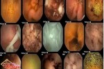 Thí nghiệm khoa học và kết quả đáng sợ từ mì ăn liền